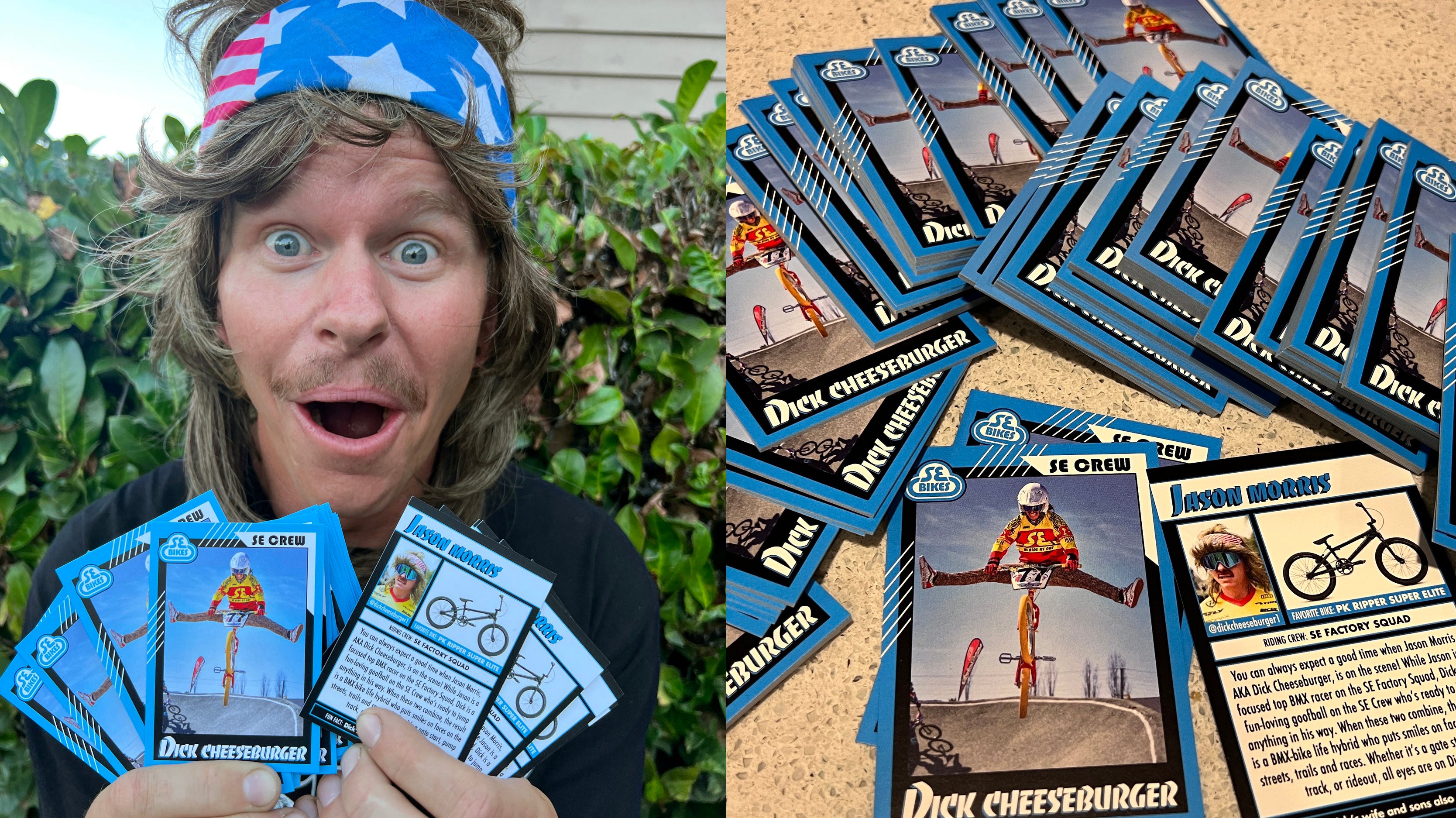 Dick Cheeseburger Trading Cards!