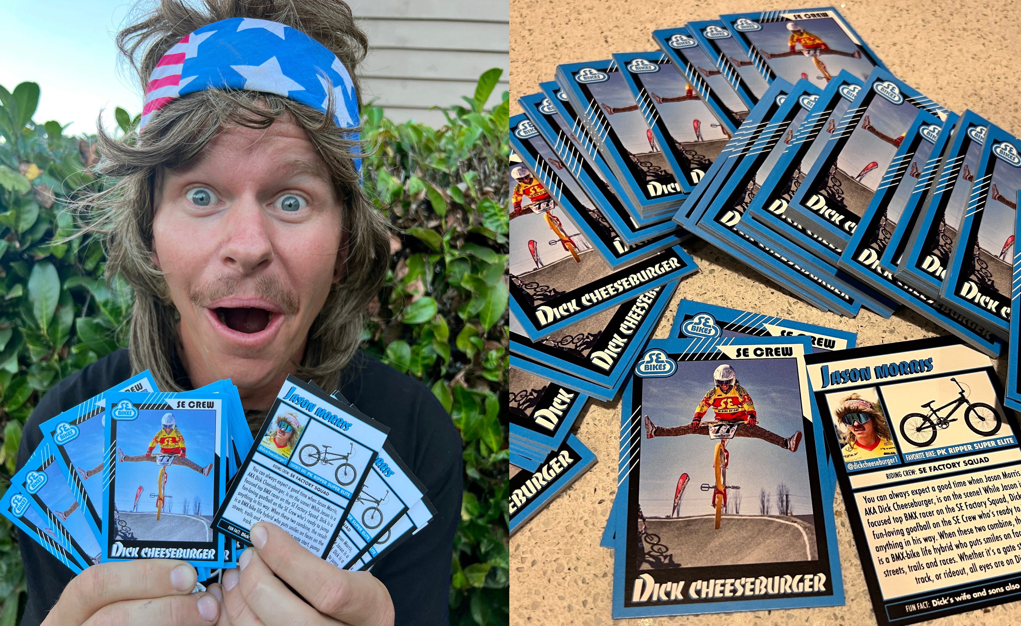 Dick Cheeseburger Trading Cards!